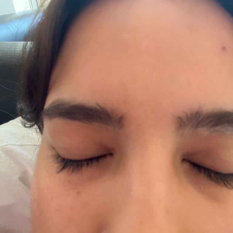 Deniz Damla Vip Çukurambar Sözde Ölçülü Kaş Alımı Kaşlarım Mahvoldu