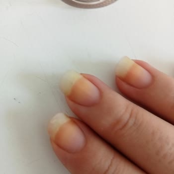 Flormar Ojesi Tırnaklarımı Sararttı