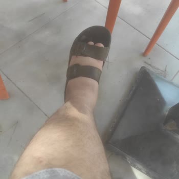 Seyfi Demirsoy Hastanesi Tomografi Sonucu Çıkmıyor