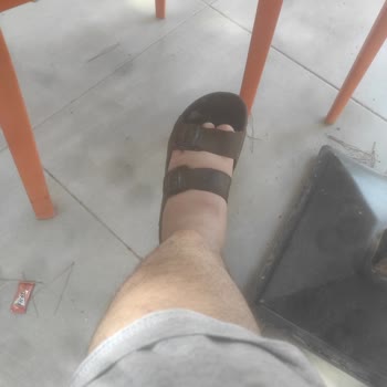 Seyfi Demirsoy Hastanesi Tomografi Sonucu Çıkmıyor