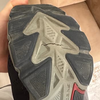 Skechers Ayakkabımın Altı Çatladı, Yarıldı!