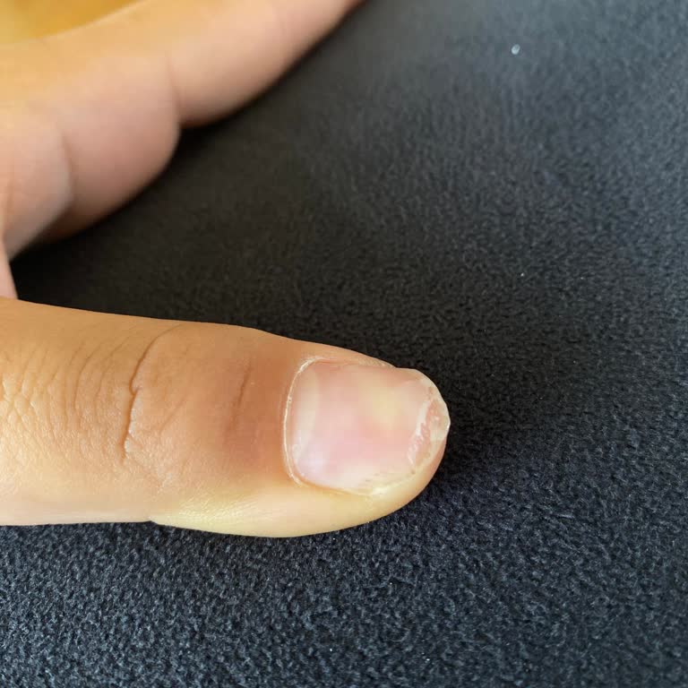 Yasmin & Eles Beauty Tırnaklarıma Kan Oturdu