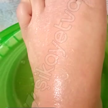 Gratis Ayak Maskesi Yanık Yaptı