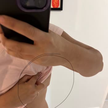 Mi Clinic (Op. Dr. Mirza Yıldırım) Mağduru