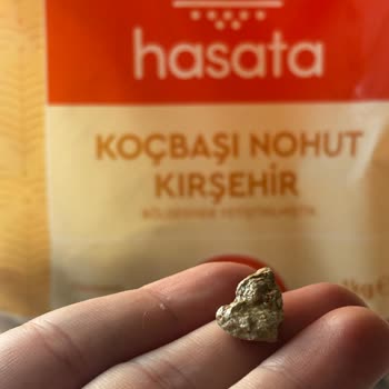 Hasata Nohuttan Çıkan Koca Taş!