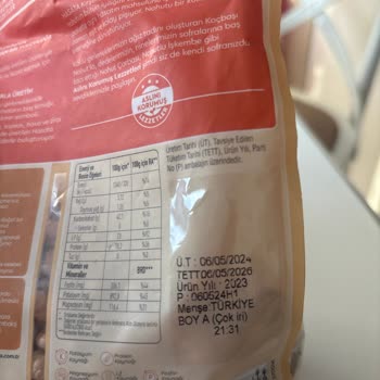 Hasata Nohuttan Çıkan Koca Taş!