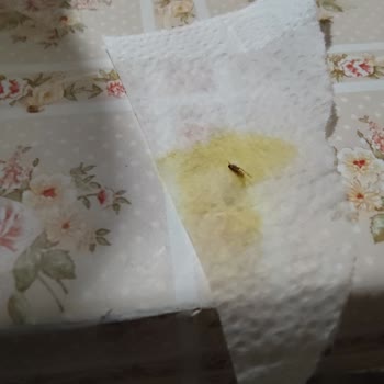 Dudomi Noodle'da Böcek Şoku: Midem Bulandı!