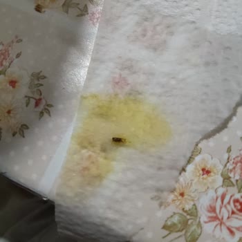 Dudomi Noodle'da Böcek Şoku: Midem Bulandı!