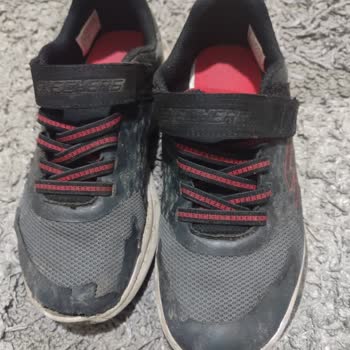 Skechers Kalitesizliği İle Yine Tüm İlgiyi Üzerine Çekiyor.