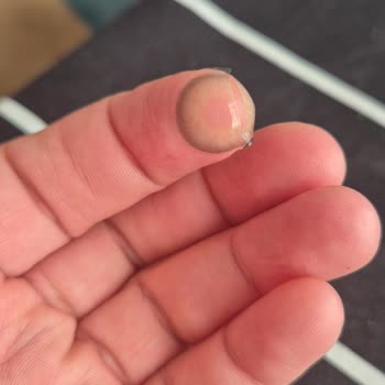 Optikzade Gözlük & Lens Lensin Kalitesi Hakkında