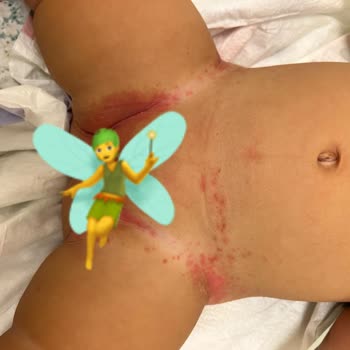 Prima Aktif Bebek Bezi 9 Aylık Bebeğimiz De Pişiğe Sebep Oldu!