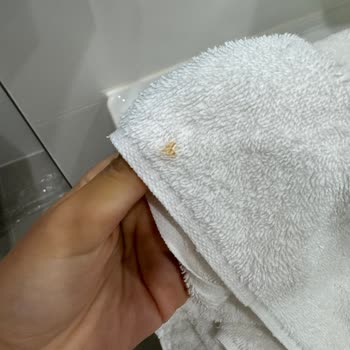 Hampton By Hilton Samsun Antalya'da Soğuk Duş Ve Kirli Havlu Sorunu