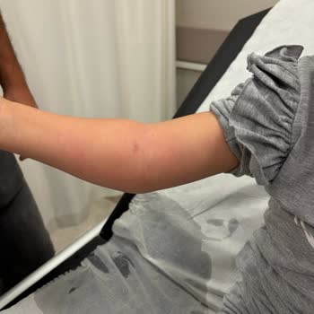 Özel Medar Hastaneleri Sakarya Hastanesi'nde Kızımın Tedavisinde Yaşadığımız Sorunlar