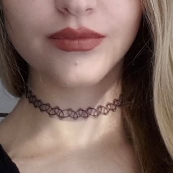 Dent Suadiye Diş Ameliyatı Sonucu Dudaklarda Asimetri Ve Sorumluluk Alınmaması