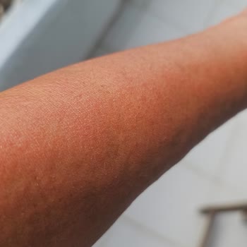 Eda Taşpınar Güneş Yağı Rezil Liği