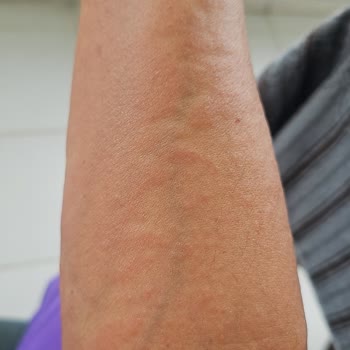 Eda Taşpınar Güneş Yağı Rezil Liği