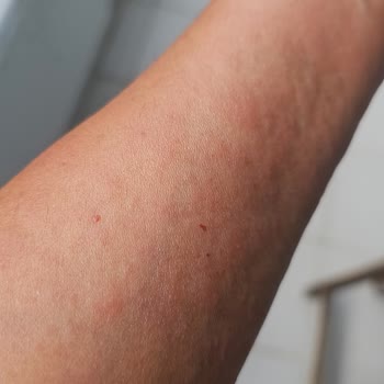 Eda Taşpınar Güneş Yağı Rezil Liği