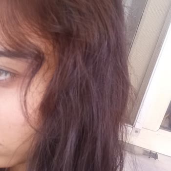 Koleston Saç Boyası Renk Sorunu Ve Cilt Reaksiyonu