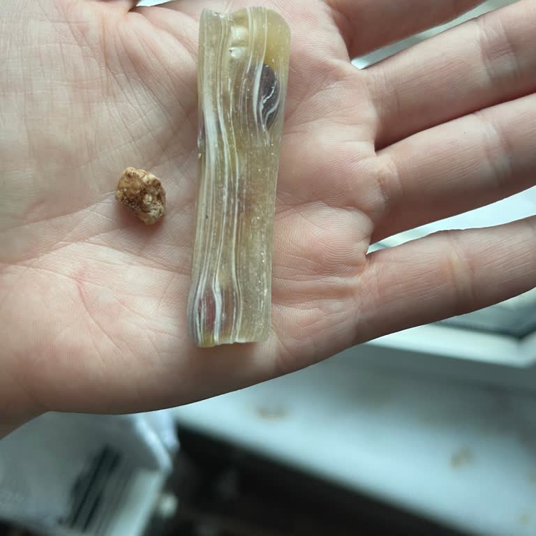 Komşu Kuruyemiş Lokumdan Taş Çıktı