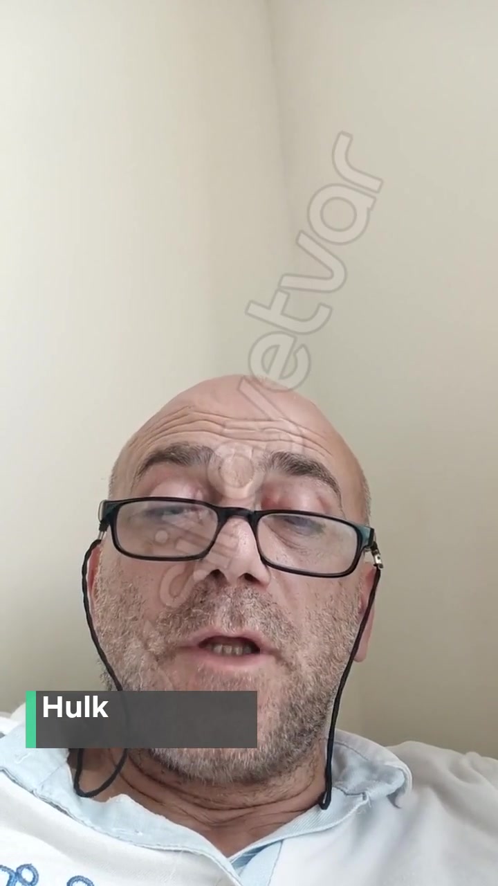 İstanbul Büyükşehir Belediyesi Mağduriyeti! videonun kapak resmi