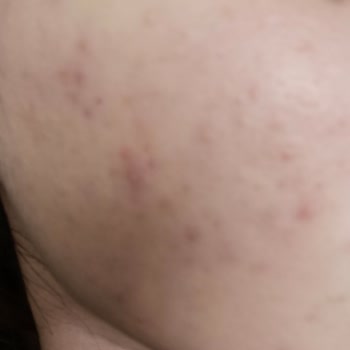 Elif Doğan (Samsun Clinic) Profesyonellikten Uzak Ve Yanıltıcı Hizmet