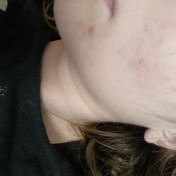 Elif Doğan (Samsun Clinic) Profesyonellikten Uzak Ve Yanıltıcı Hizmet