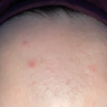 Prof. Dr. Emel Bülbül Başkan İlgisiz Doktor Ve Etkisiz Tedavi Süreci!