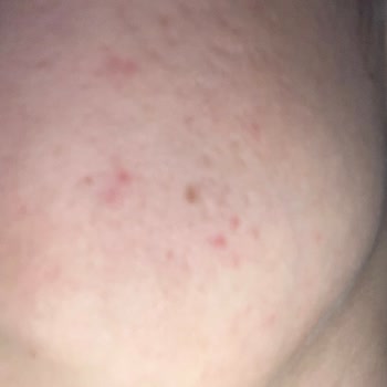 Prof. Dr. Emel Bülbül Başkan İlgisiz Doktor Ve Etkisiz Tedavi Süreci!