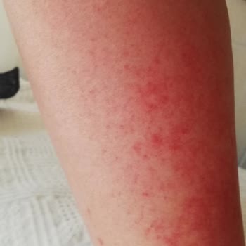 Celenes By Sweden Güneş Koruyucunun Koruyamaması