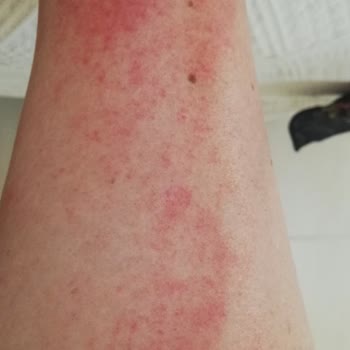 Celenes By Sweden Güneş Koruyucunun Koruyamaması