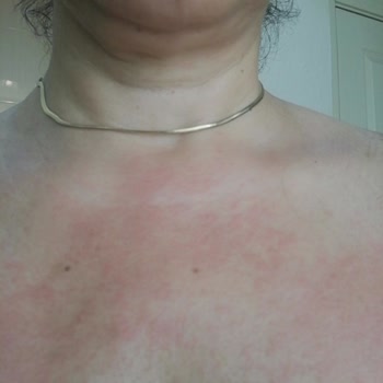 Celenes By Sweden Güneş Koruyucunun Koruyamaması