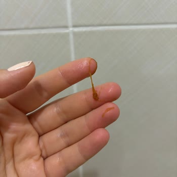 Daily Dream Care Saç Toniği Sivilcelenme Kaşıntı Ve Deri Yanması