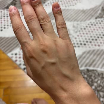 Apple Watch 9 Media Markt Alerji Şikayeti