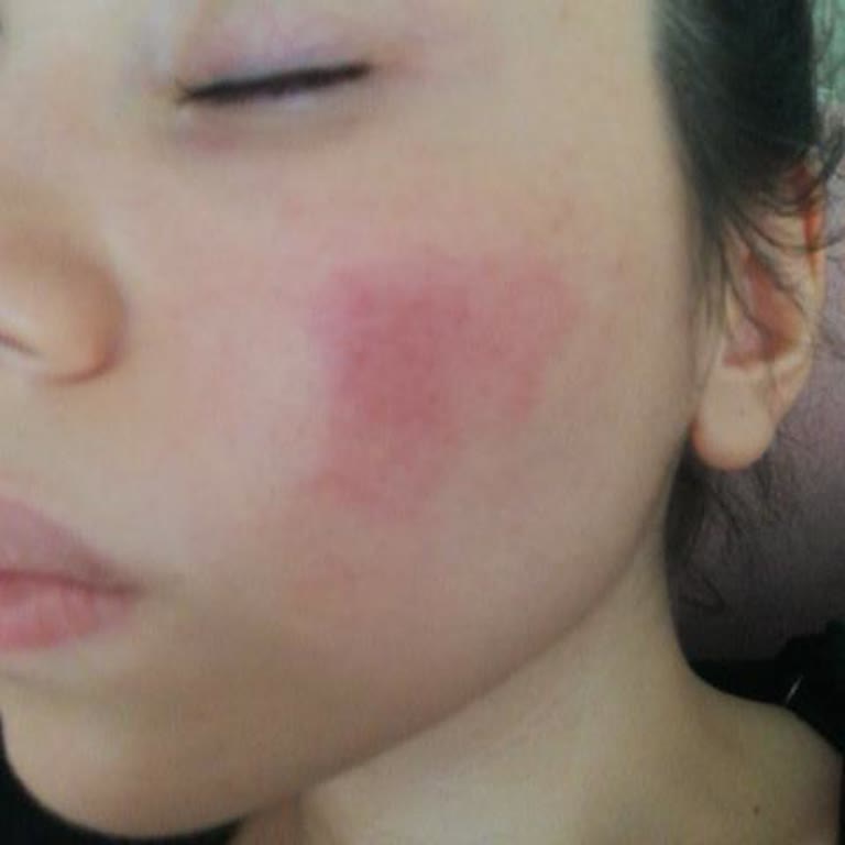 Abdi İbrahim Expigment %4 Krem Yüzümü Yaktı