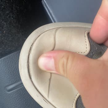 Yalçın Kundura (Ordu) Garanti Sürecinde Yaşanan Sorunlar