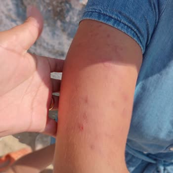 A101 Otizmli Çocuğa Hakaret Ve Anneye Şiddet!