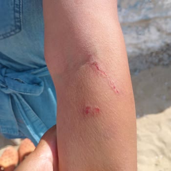 A101 Otizmli Çocuğa Hakaret Ve Anneye Şiddet!