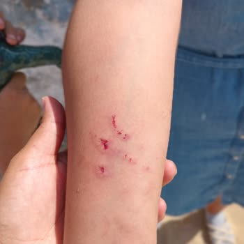 A101 Otizmli Çocuğa Hakaret Ve Anneye Şiddet!