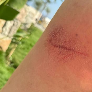 Anda Barut Collection Anda Barut'ta Korkunç Tatil Deneyimi: Sağlık Ve Saygı Sorunları