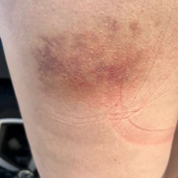 Anda Barut Collection Anda Barut'ta Korkunç Tatil Deneyimi: Sağlık Ve Saygı Sorunları