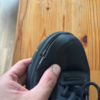 Skechers Ayakkabım 2 Defa Parçalandı Ve "kullanım Hatası" Denildi