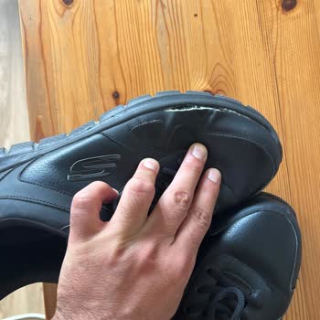 Skechers Ayakkabım 2 Defa Parçalandı Ve "kullanım Hatası" Denildi