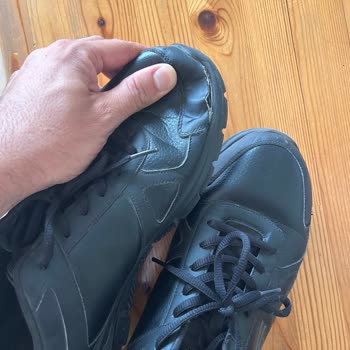 Skechers Ayakkabım 2 Defa Parçalandı Ve "kullanım Hatası" Denildi