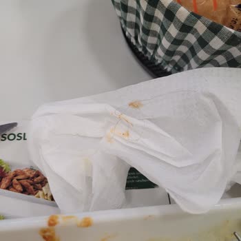 Köfteci Ramiz Tabağımdan Uzun Saç Çıktı Midem Bulanıyor