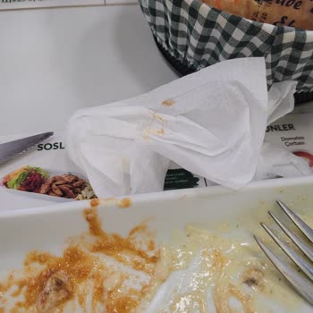 Köfteci Ramiz Tabağımdan Uzun Saç Çıktı Midem Bulanıyor