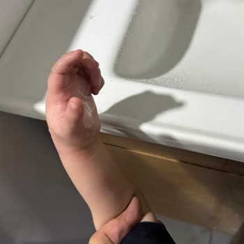 Dr. Nevruz Erez Devlet Hastanesi Iğdır Devlet Hast. Çocuk Acil Doktor İhmali Oğlumun Sağlığına Mal Oldu