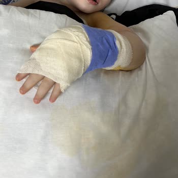 Dr. Nevruz Erez Devlet Hastanesi Iğdır Devlet Hast. Çocuk Acil Doktor İhmali Oğlumun Sağlığına Mal Oldu