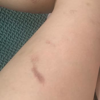 Zendora Deluxe Epilasyon Hizmetinde Yaşanan Sorunlar Ve Müşteri Memnuniyetsizliği