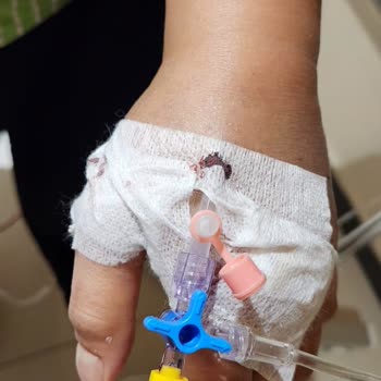 Özel Jimer Hastanesi Jimer Hemşireleri İşi Bilmiyor