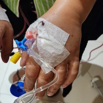Özel Jimer Hastanesi Jimer Hemşireleri İşi Bilmiyor